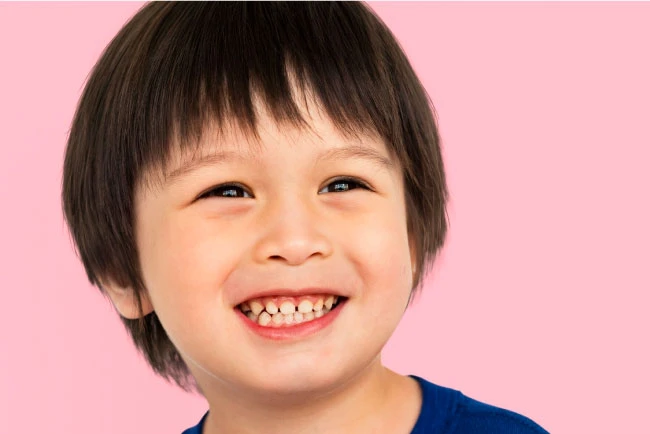 เด็กยิ้มแสดงให้เห็นฟันน้ำนม