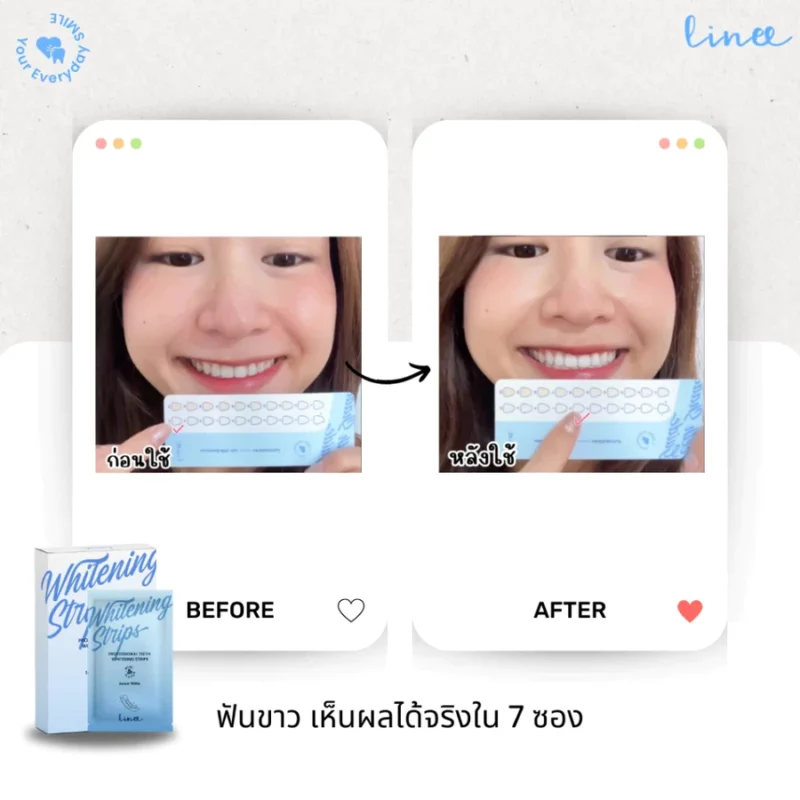 แผ่นแปะฟันขาว Linee Teeth Whitening Strips (14 ซอง) - Image 6